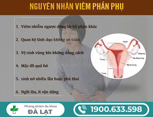 Hình ảnh minh họa